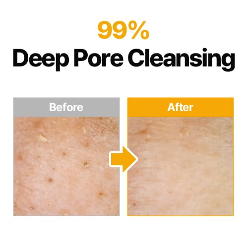MANYO Pure Cleansing Oil - Korean Facial Cleanser for Blackhead Removal | Daily Makeup Removal, 6.7 fl oz (2 Pack)