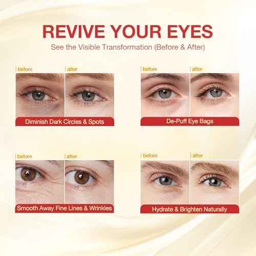 GONIM Under Eye Patches 360¡Æ Fit, Eye Mask with Collagen Peptide, Salmon DNA PDRN, Retinol & Niacinamide, Eye Patches for Puffy Eyes and Dark Circles, Travel Essentials 4 pairs