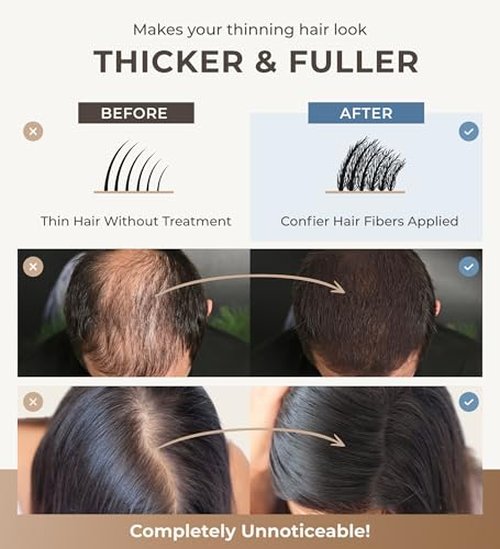 CONFIERR Keratin Hair Fibers for Men & Women - Fill In Fine or Thinning Hair, Instantly Thicker, Fuller Looking Hair (Auburn 15g)