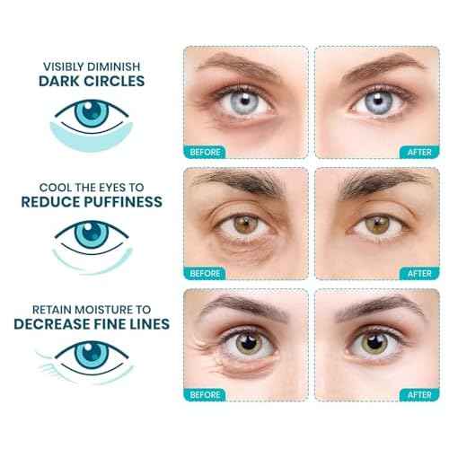 Stylia Collagen & Vitamin C Under Eye Patches for Puffy Eyes & Dark Circles - Depuffing, Hydrating & Firming Under Eye Mask with Hyaluronic Acid - Vegan, Cruelty-Free Skincare (30 Pairs)