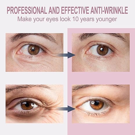 Temporary Eye Tightener Eye Cream,Instant Reduces Under-Eye Bags,dark circles,daily anti-aging,eye cream quick repair wrinkles,contains retinol and hyaluronic acid anti-aging,reduce fine lines 0.68 oz