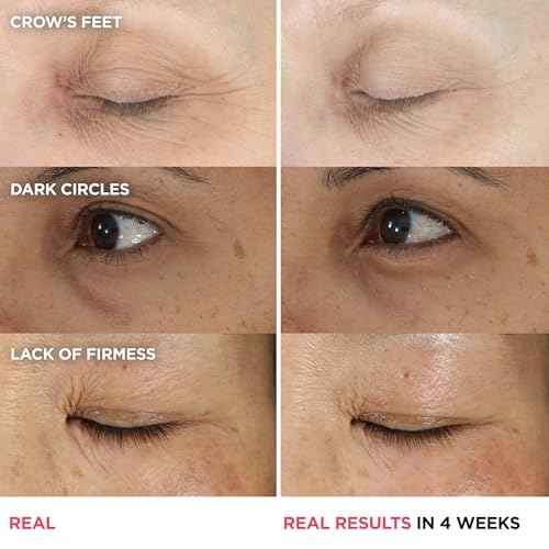 IT Cosmetics Confidence in an Eye Cream - Anti Aging Peptide Eye Cream for Dark Circles & Wrinkles, Lightweight 48HR Hydration, 2% Super Peptide Concentrate, Smooth & Brighten Undereye, All Skin Types