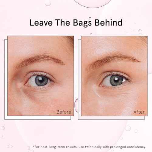 grace & stella Under Eye Brightener Roller - Airplane Travel Essentials - Travel Size Toiletries - Retinol & Caffeine Eye Serum for Puffiness, Dark Circles, Wrinkles - Vegan Skincare (15ml / 0.51floz)