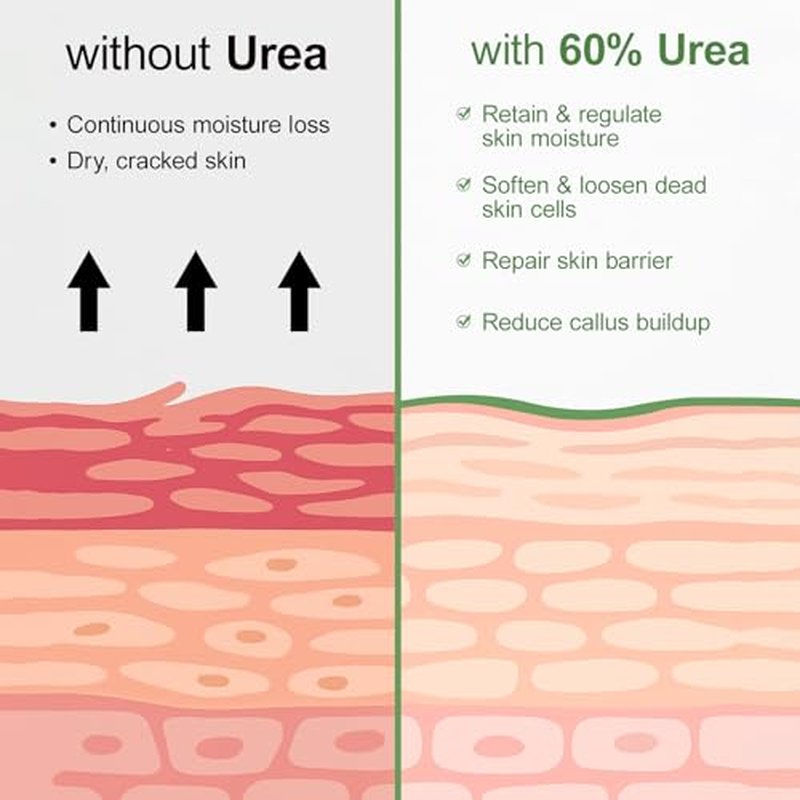 YAFUSIPE 60% Urea Cream Stick plus 2% Salicylic Acid,Foot Callus Remover - Urea Cream 60% for Feet Cracked Skin, Dry Cracked Feet & Hands Moisturizer, Foot Care Balm 1.4oz