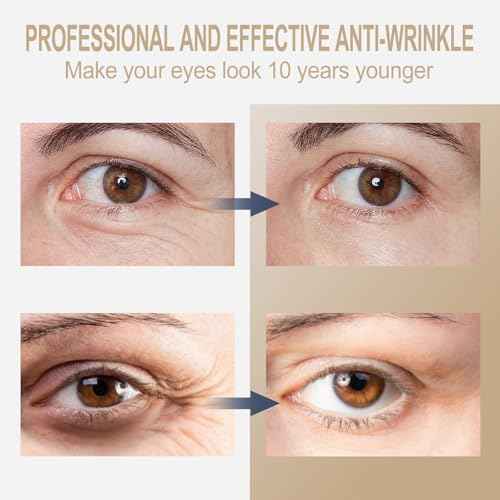 Temporary Instant eye Tightening cream, Quickly Reduces eye bags and dark circles,daily anti-aging,quickly repairs wrinkles,reduces fine lines,contains hyaluronic acid retinol-Locks in Moisture-AAA