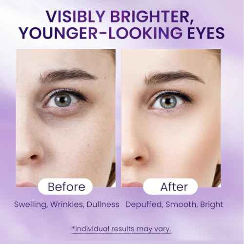 Caffeine & Retinol Under Eye Serum ? Dermatologist-Tested, Fast Absorbing, Correction for Puffy Eye Bags Fine Lines Dark Circles Wrinkles While Providing Moisturizing Care