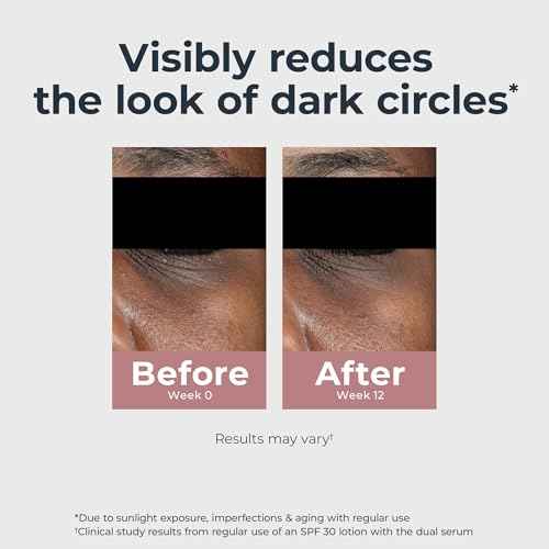 Eucerin Radiant Tone Eye Cream Dark Circle Corrector, Eye Brightening Cream with Thiamidol and Hyaluronic Acid, Helps Reduce the Look of Eye Puffiness, 0.5 Oz Tube