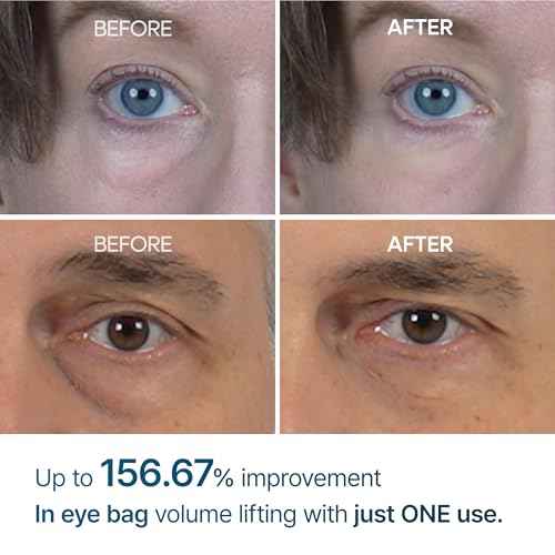 Dr.Melaxin Eyephalt Eyebag Cream 10ml