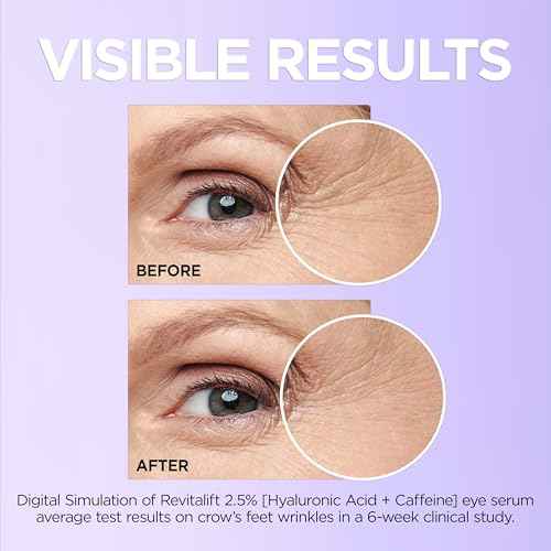 L'Oreal Paris Revitalift Hyaluronic Acid + Caffeine Hydrating Eye Serum for Dark Circles, Fragrance Free .67 fl. oz + Moisturizer Sample