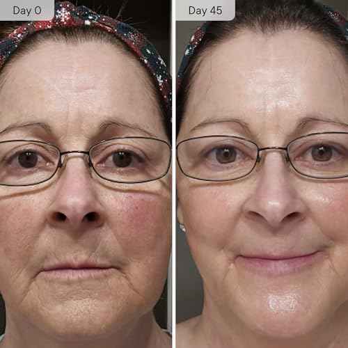 Qure Micro Infusion System for Face & Neck - Facial Moisturizing Essence, Even-looking tone, Serum for All Skin Types, Refreshed and Luminous Skin - 5-Month Supply