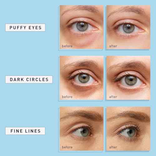 Enaskin Naturals Under Eye Patches for Dark Circles: 30 Pairs Retinol Collagen Eye Gels Mask - Reduce Wrinkles Puffy & Bags - Skin Treatment Pads - Anti Aging Moisturizer For Women (Blue)