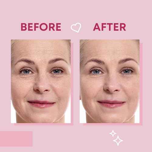Forehead Wrinkle Patches and Smile Line Patches Set | Hyaluronic Acid Aloe Collagen Vitamin E | Overnight Treatment for Fine Lines Nasolabial Folds and Facial Wrinkles | Non-Invasive Skin-Friendly