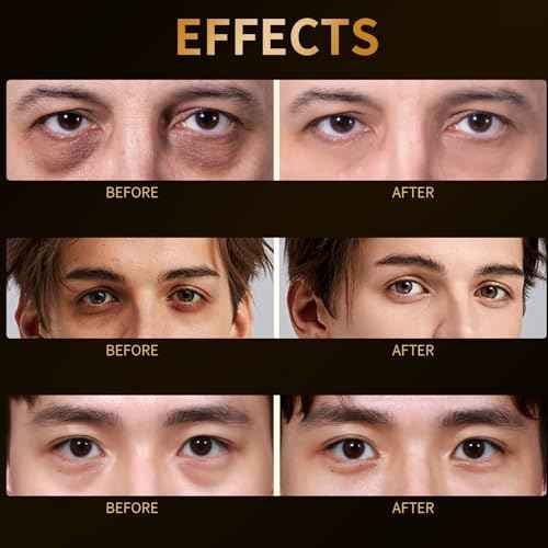 Eye Repair Stick for Men, Reduces Under Eye Dark Circles & Eyebags, Eyes Cooling Stick Hydrates and Depuffing 0.34 Fl.Oz (1)