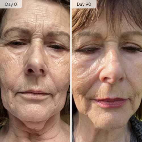 Qure Micro Infusion System for Face & Neck - Facial Moisturizing Essence, Even-looking tone, Serum for All Skin Types, Refreshed and Luminous Skin - 5-Month Supply