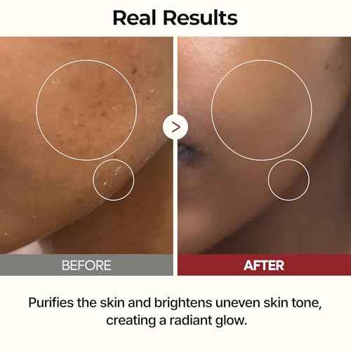 Dr.Melaxin Peel Shot Glow Rice Toner 200ml hydrated Skin Cleansing Skin Korean Skin Care