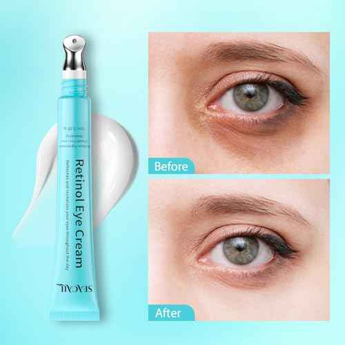 Retinol Eye Cream - Eye Serum for Dark Circles & Puffiness Anti-Aging - Under Eye Cream with Hyaluronic Acid & Caffeine to Reduce Wrinkles & Repair the Eye Area (15ml)