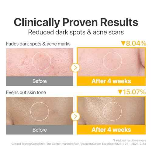 numbuzin No.5 Toner Pads | Vitamin-Niacinamide Concentrated Pad | Double-Sided | Glutathione, Niacinamide, PHA & LHA | Exfoliation, Hyperpigmentation Care | 70 Pads/180 ml