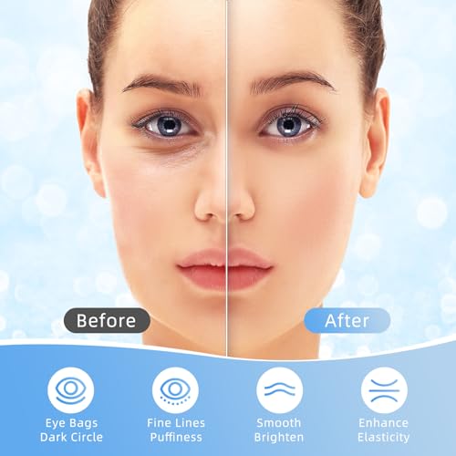 Under Eye Patches, 20 Pairs Eye Mask for Dark Circles,Puffy Eyes,Undereye Bags,Wrinkles,Eye Mask Patches with Hyaluronic Acid, 24K Gold,Rose & Aloe Vera,Eye Treatment Skin Care for Men & Women Gift