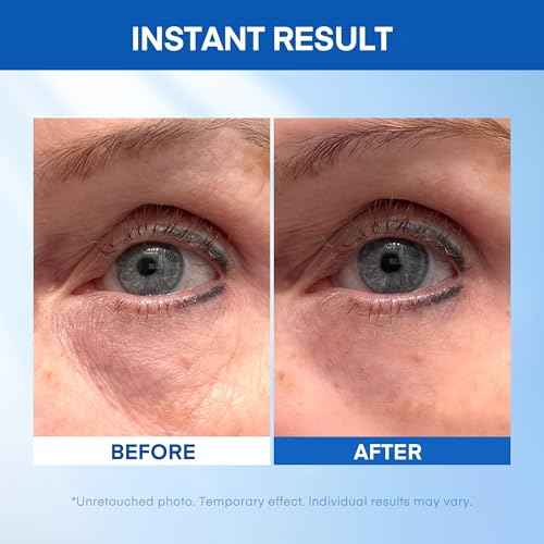 Instant Under Eye Lift Serum - Reduces Eye Bags, Wrinkles, Puffy Eyes, Dark Circles & Crow¡¯s Feet in Minutes - Advanced Firming Polysaccharide Formula for Mature Skin - 20 mL