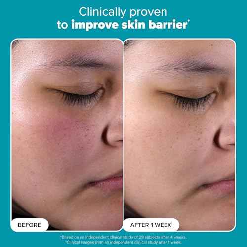 Paula's Choice SKIN PERFECTING 2% BHA Liquid Exfoliant with Salicylic Acid, Facial Polish for Enlarged Pores, Wrinkles & Fine Lines, Suitable for Blackhead-Prone Skin, Fragrance-Free