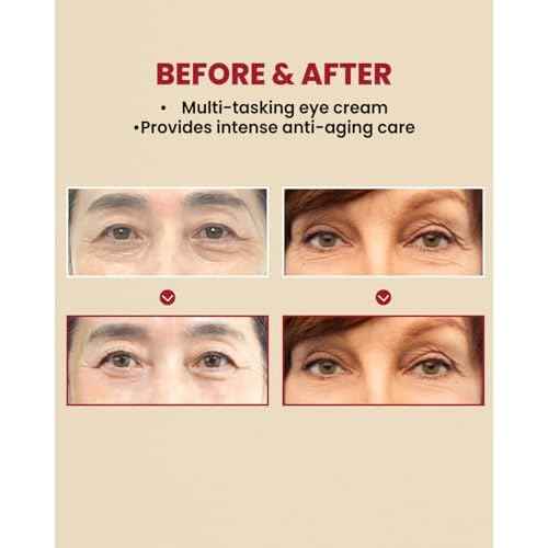 KSECRET SEOUL 1988 Retinal Eye Cream ? Formulated with Advanced Retinal Liposome 4% and Fermented Bean for Dark Circles and Fine Line Care | Korean Skincare, 30ml / 1.01 fl oz