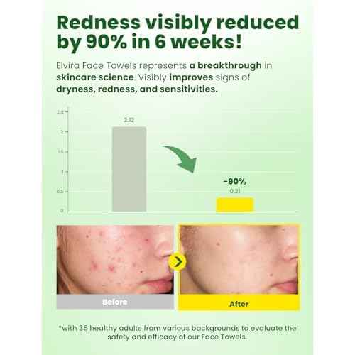 Elvira 100 Count Disposable Face Towels, Biodegradable Facial Cleansing Towels, Ultra Soft & Thick Cloth for Sensitive Skin, Makeup Remover Dry Wipes, Lint-Free Towelettes for Cleansing