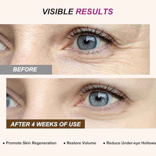 Calcium Volume Multi Balm,Intensive Repair & Moisturizing Cream,Hydrating,Firming Skin,Suitable for Eyes,Neck,Face,0.32 oz/9 g (Pack of 2)