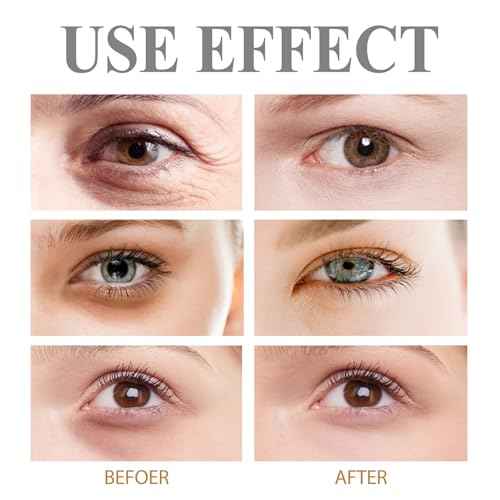 Firming Eye Gel with Hyaluronic Acid & Collagen ? Hydrating Treatment to Reduce Fine Lines, Lightweight Anti-Aging Under Eye Cream for Daily Use