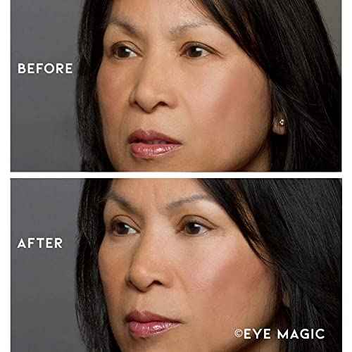 Premium Eye Lift Strips for Droopy, Sagging, or Hooded Eyelids, Instant Non-Surgical Eyelid Tape, Hypoallergenic, Transparent, Strong Hold, 80 Count, S/M Size, Made in USA