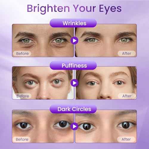 Retinol Eye Cream for Dark Circles and Puffiness, Hydrating Under Eye Cream for Dark Circles, Anti Aging Dark Circle Eye Cream for Fine Lines, Wrinkles, Firming Eye Contour, 1.06 oz