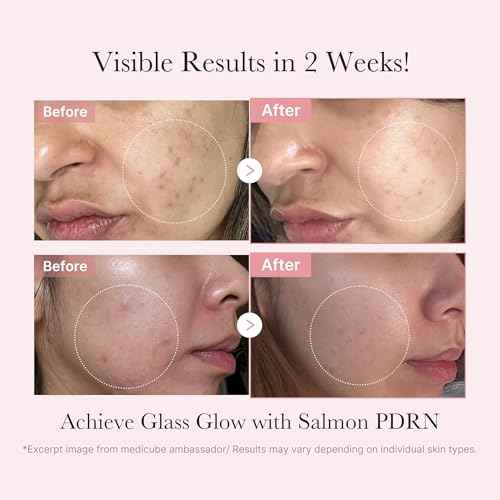 medicube Pink PDRN Trio Gift Set for Glass Glow Skin -Hydrating, Firming, and Radiance-Boosting Skincare Set for Women & Girls | With Salmon DNA PDRN, Peptides and Pink Vitamin | Korean Skincare