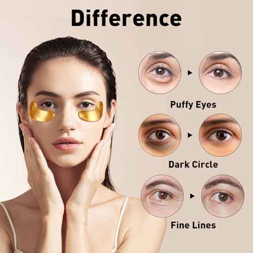 CHMI Under Eye Patches (200 Pairs) - 24K Gold Eye Patches for Puffy Eyes, Dark Circles, EyeBags and Wrinkles, Collagen Skin Care Products, Beauty & Personal Care