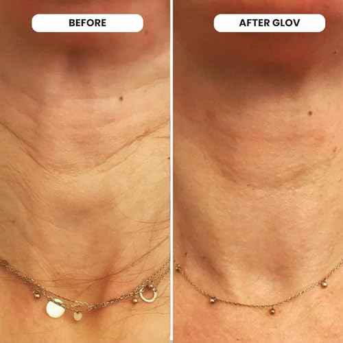 Glov Beauty Micro Infusion System for Face & Lips ? 0.25mm 24k Gold Cosmetic Facial Stamp with Hyaluronic Acid, Collagen Peptides & Licorice Root Serum Ampoules | At-Home Hydrating & Plumping Glow Kit