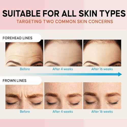 Forehead Wrinkle Patches Overnight 12 Pcs with Collagen: Forehead Fine Lines and Deep Wrinkles Treatment Remover, Anti Forehead and Between the Eyes Facial Wrinkle Patches, Hypoallergenic Patches