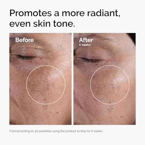 The Ordinary Glycolic Acid 7% Exfoliating Toner, Brightening and Smoothing Daily Toner for More Even-Looking Skin Tone