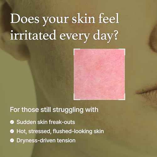 I'm From Mugwort Essence | Vegan Extract - Soothe Sensitive and Irritated Skin, Redness Relief, Refreshing, Korean Hydrating Toner | 5.4 Fl Oz, All Skin Types, PETA Approved