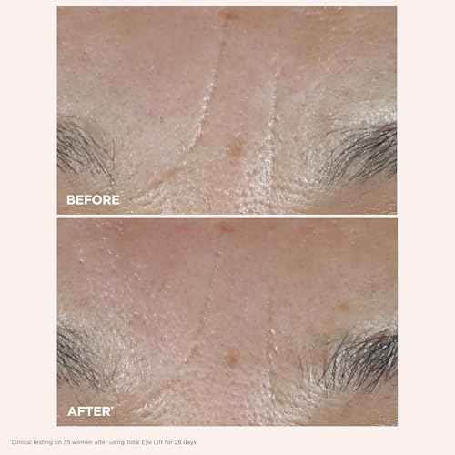 Clarins NEW Total Eye Lift | Anti Aging Eye Cream | Targets Wrinkles, Crow's Feet, Dark Circles and Puffiness For a Visible Eye Lift in 30 Seconds | REFILLABLE