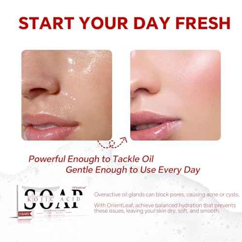 Kojic Acid Soap, Turmeric Soap Bar for Dark Spots, Fresh Citurs Scent, Gentle for Face and Body Wash with Vitamin C, Shea Butter, Retinol, Olive Oil, Collagen (3 PACK)