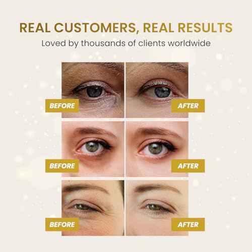 PLANTIFIQUE Gold Eye Patches for Puffy Eyes | 20 Pairs | Gifts | Under Eye Masks for Dark Circles | Puffiness Eye Gels | Eye Mask Skincare