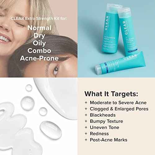 Paula's Choice CLEAR 3-Piece Acne Kit, Includes Daily Cleanser, 2% Salicylic Acid Exfoliant & Benzoyl Peroxide Treatment, Prevents & Treats Mild to Severe Acne & Breakouts, Fragrance-Free, Set of 3