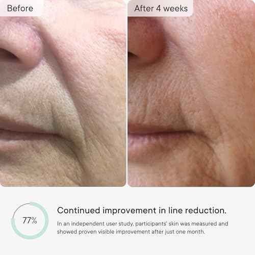 Qure Micro-Infusion Anti Wrinkle Patches for Smile Line, Frown lines, Under Eye Bags, Puffiness, Crow's Feet - Retinol, Caffeine, Peptides - Dissolvable for Overnight Use - 8 Pairs