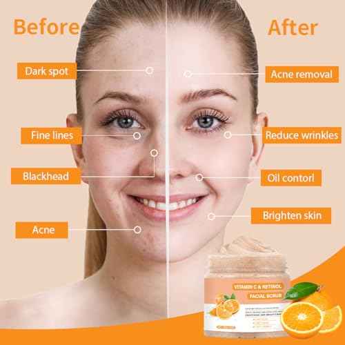Vitamin C Face Scrub, Exfoliating Facial Wash with Retinol, Facial Scrub,Facial Exfoliating Scrub, Facial Scrubs for Women,Deep Cleansing Face Wash Cleanser for Women Men