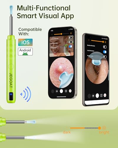 Ear Wax Removal, Ear Cleaner with Camera, Ear Cleaning Kit 1296P HD Ear Scope, 6 LED Lights and 10 Ear Picks, Earwax Removal with Otoscope to Earify Earwax, iOS and Android