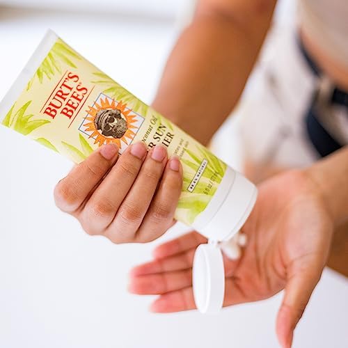 Burt's Bees After Sun Lotion - Hydrating Aloe Vera & Coconut Oil for Sunburn Relief | 6 oz