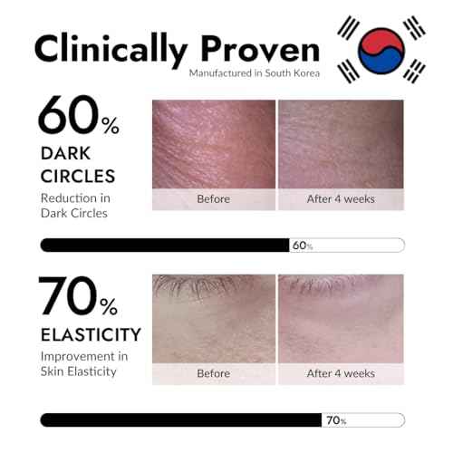 MIZON Under Eye Patches for Puffy Eyes & Dark Circles, 24K Gold & Snail Mucin, 60 Pcs ? Anti-Wrinkle Collagen & Peptide Formula ? Moisturizing Korean Eye Mask for Elasticity