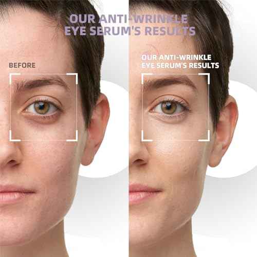 5% Caffeine Eye Cream & Under Eye Serum for Dark Circles and Puffiness, 360¡Æ Massage Roller Ball Eyes Treatment Serum, Reduces Wrinkles Fine Lines for Women