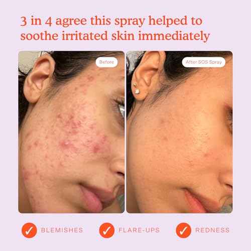 Tower 28 SOS Daily Rescue Facial Spray for Sensitive Skin, Hypochlorous Acid Spray Helps Reduce Redness and Breakouts, Full Size Toner for Face, 4 FL Oz