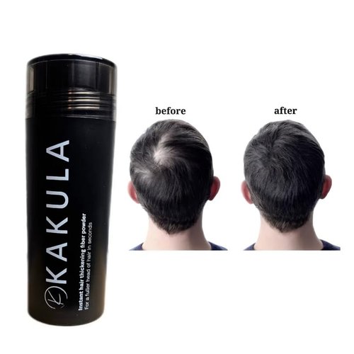 KAKULA Keratin Hair Building Fibers – Instant Hair Thickener & Bald Spot Concealer for Men & Women – Natural Keratin Powder for Thinning Hair, Root Touch Up & Gray Hair Coverage – 27.5g (Black)