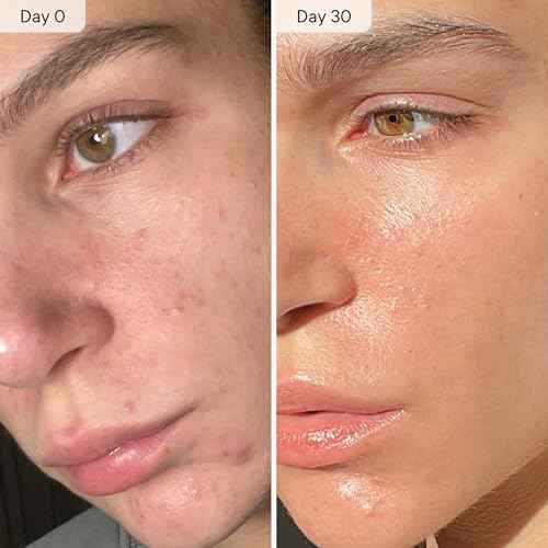 Qure Micro Infusion System for Face & Neck - Facial Moisturizing Essence, Even-looking tone, Serum for All Skin Types, Refreshed and Luminous Skin - 5-Month Supply