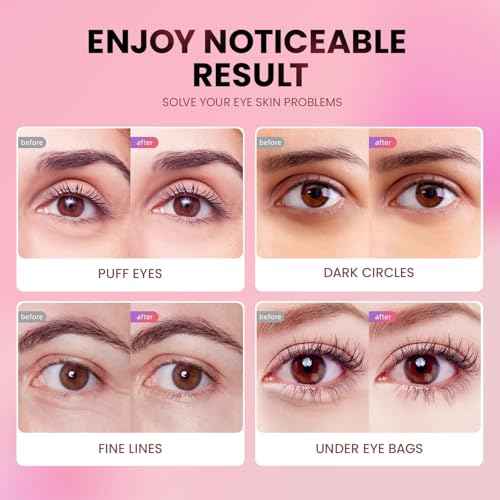 Under Eye Patches (24 Pairs) - New Tri-color Glitter Eye Gel Pads for Dark Circles Puffy Eyes,Under eye Bags,Wrinkles|Natural Collagen Under Eye Mask Patches, Gel Under Eye Patches